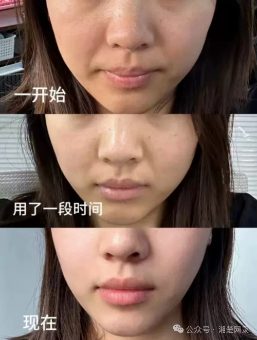 護膚品補水好評語30字_護膚品補水好還是緊致好_補水好的護膚品